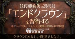 低侵襲修復の選択肢「エンドクラウン」を習得する
