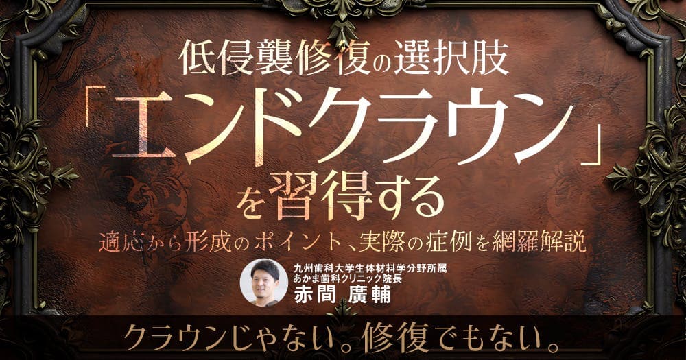 低侵襲修復の選択肢「エンドクラウン」を習得する