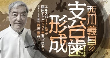 西川 義昌の支台歯形成