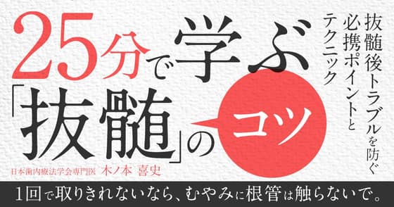 25分で学ぶ「抜髄」のコツ