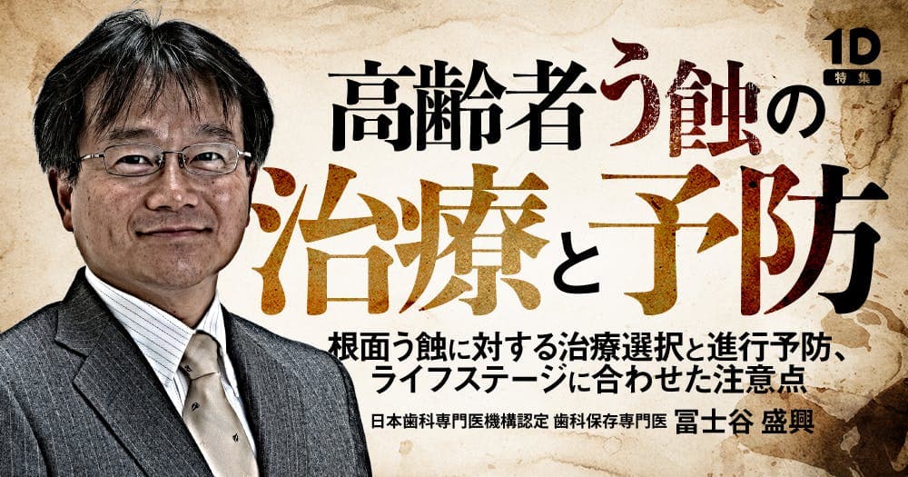 高齢者う蝕の治療と予防