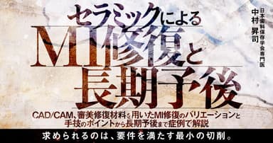 セラミックによるMI修復と長期予後