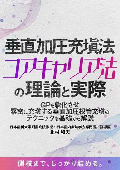 ランキング13位の垂直加圧充塡法「コアキャリア法」の理論と実際