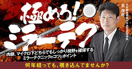 極めろ！ミラーテク