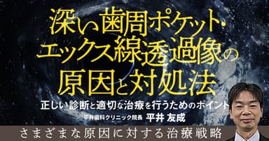 深い歯周ポケット・エックス線透過像の原因と対処法。歯周ポケット掻爬以外の方法は？