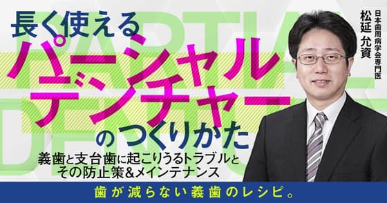 長く使える「パーシャルデンチャー」のつくりかた