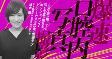 爆速口腔内写真撮影