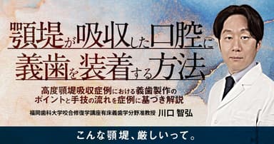 顎堤が吸収した口腔に義歯を装着する方法