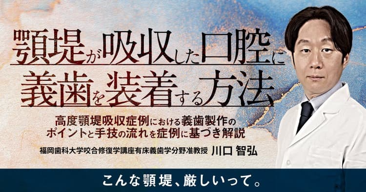 顎堤が吸収した口腔に義歯を装着する方法