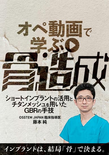 ランキング9位のオペ動画で学ぶ「骨造成」