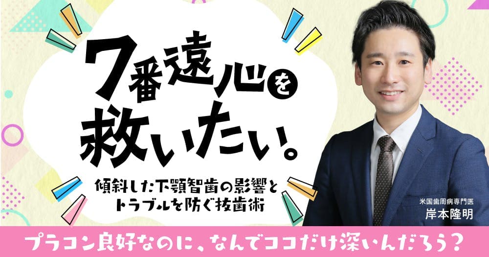 7番遠心を救いたい。 - 傾斜した下顎智歯の影響とトラブルを防ぐ抜歯術