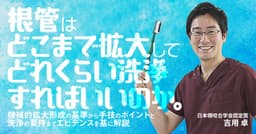 根管はどこまで拡大してどれくらい洗浄すればいいのか。