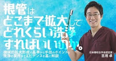 根管はどこまで拡大してどれくらい洗浄すればいいのか。