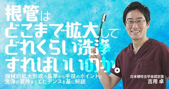 根管はどこまで拡大してどれくらい洗浄すればいいのか。