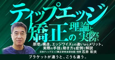 ティップエッジ矯正の理論と実際