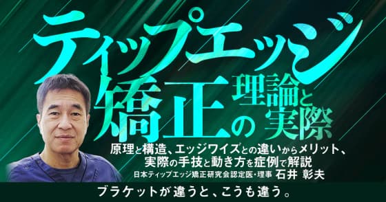 ティップエッジ矯正の理論と実際