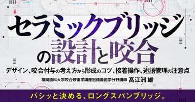 セラミックブリッジの設計と咬合