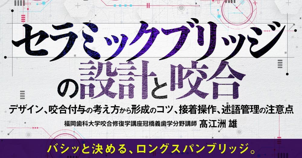 セラミックブリッジの設計と咬合 - デザイン、咬合付与の考え方から形成のコツ、接着操作、述語管理の注意点