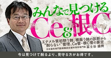 みんなで見つけるCe＆根C