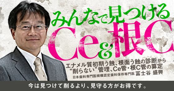 みんなで見つけるCe＆根C