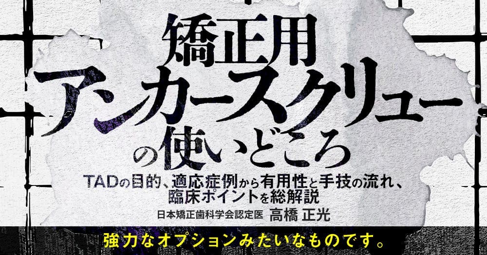 矯正用アンカースクリューの使いどころ - TADの目的、適応症例から有用性と手技の流れ、臨床ポイントを総解説