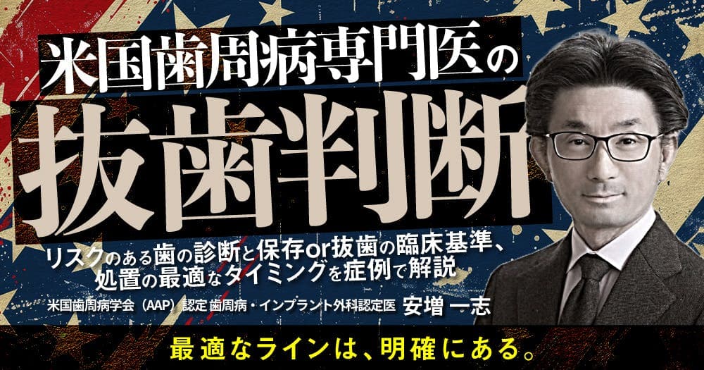 ”米国歯周病専門医”の抜歯判断 - リスクのある歯の診断と保存or抜歯の臨床基準、処置の最適なタイミングを症例で解説
