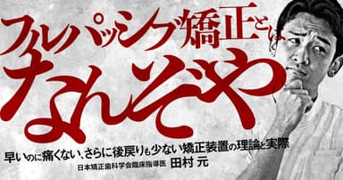 「フルパッシブ矯正」とはなんぞや