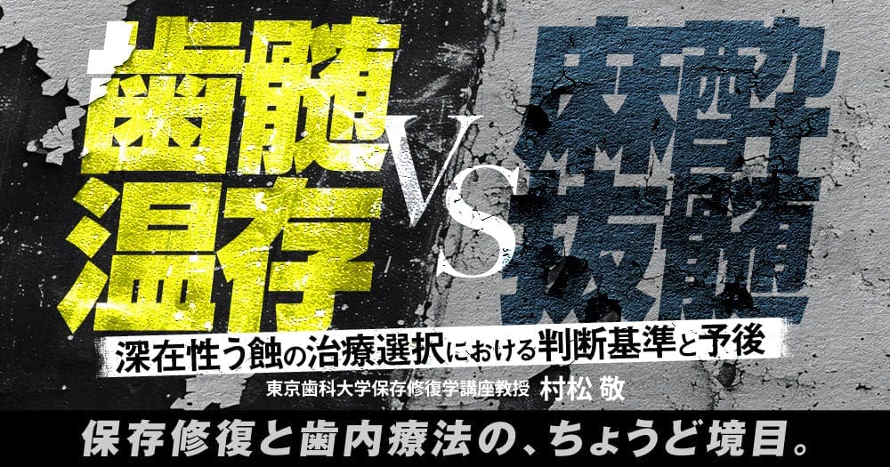 「歯髄温存」vs「麻酔抜髄」 - 深在性う蝕の治療選択における判断基準と予後