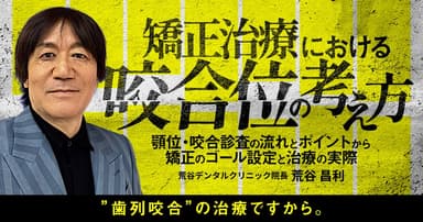 矯正治療における咬合位の考え方