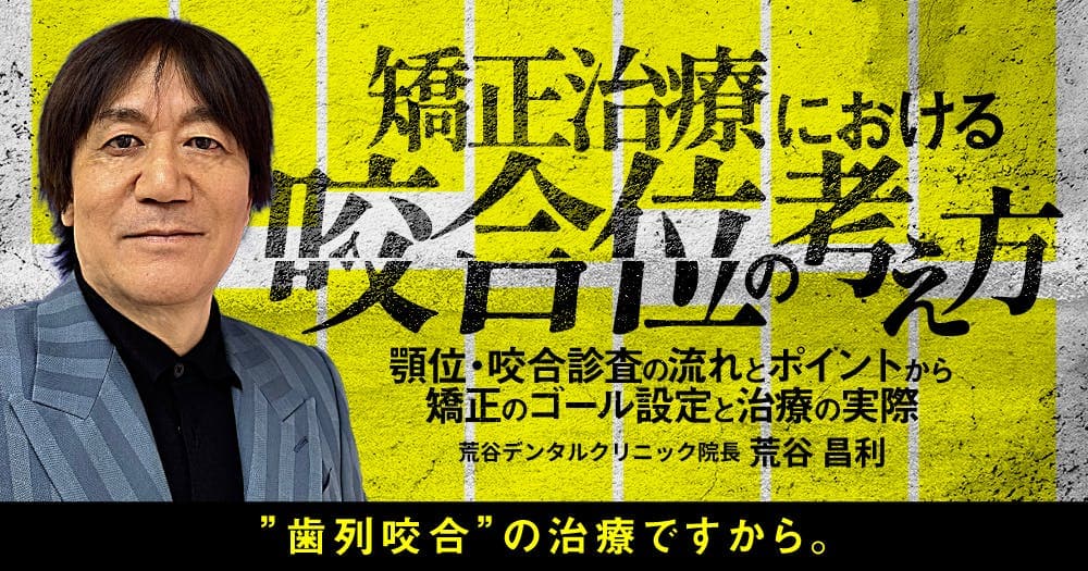 矯正治療における咬合位の考え方