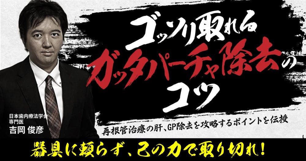 ゴッソリ取れる「ガッタパーチャ除去」のコツ - 再根管治療の肝、GP除去を攻略するポイントを伝授