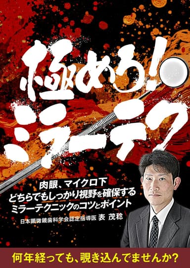 ランキング2位の極めろ！ミラーテク
