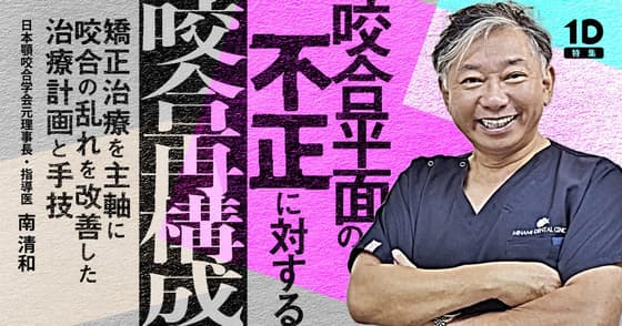咬合平面の不正に対する咬合再構成