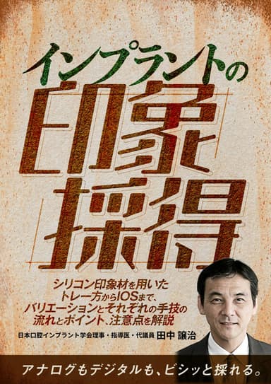 ランキング17位のインプラントの印象採得