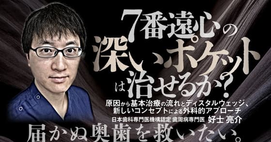 7番遠心の深いポケットは治せるか？