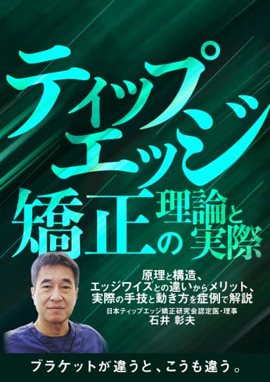 ランキング18位のティップエッジ矯正の理論と実際