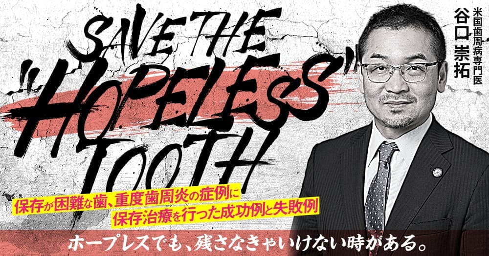  SAVE THE "HOPELESS" TOOTH