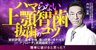 ハマらない上顎智歯抜歯のコツ