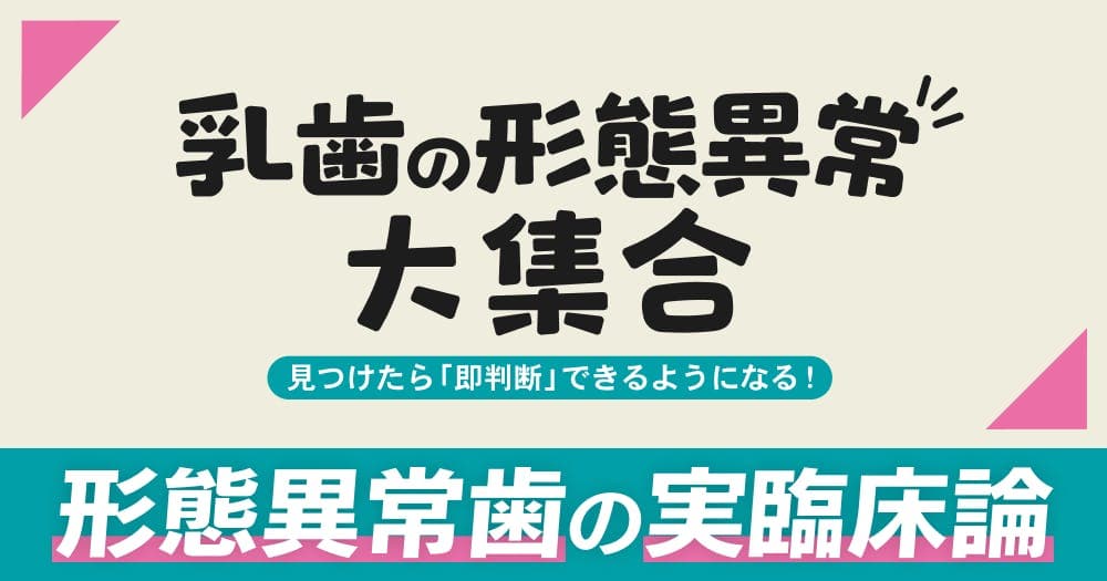 乳歯の形態異常大集合 - 原因、対応法と介入のタイミング