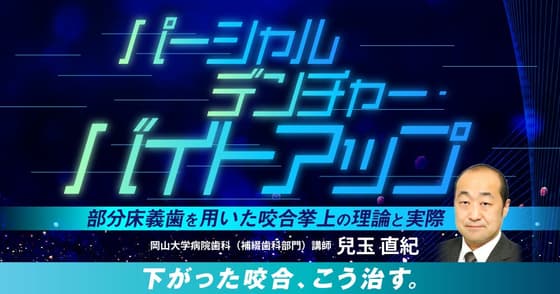 パーシャルデンチャー・バイトアップ