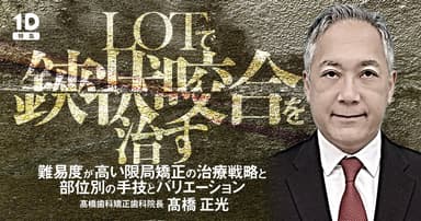 LOTで鋏状咬合を治す