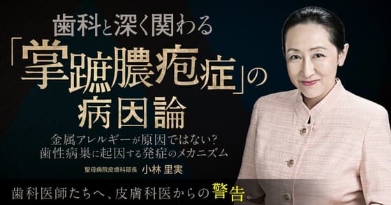 歯科と深く関わる「掌蹠膿疱症」の病因論