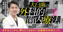 大臼歯の外科的歯内療法