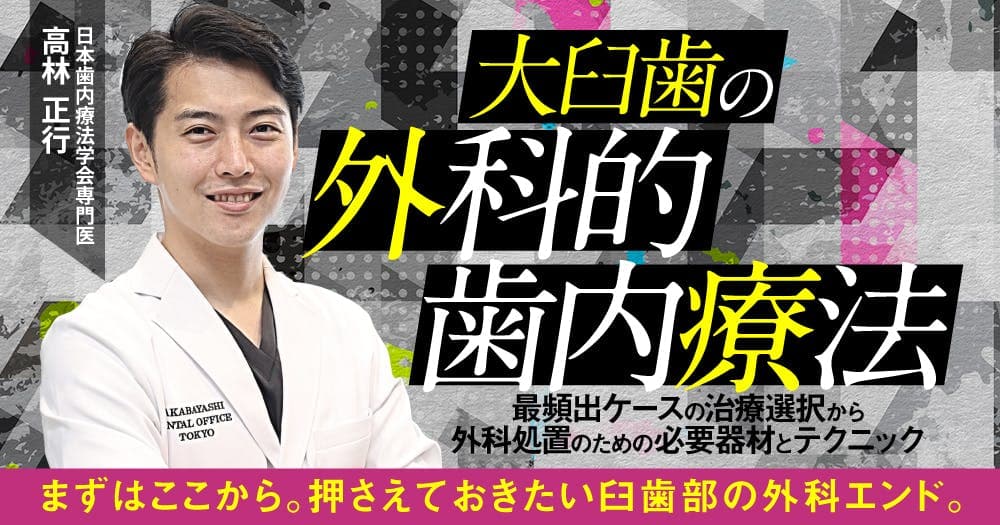 大臼歯の外科的歯内療法 - 最頻出ケースの治療選択から外科処置のための必要器材とテクニック