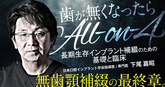歯が無くなったら「All-on-4」