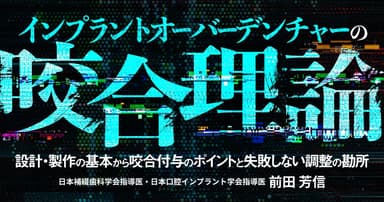 インプラントオーバーデンチャーの咬合理論