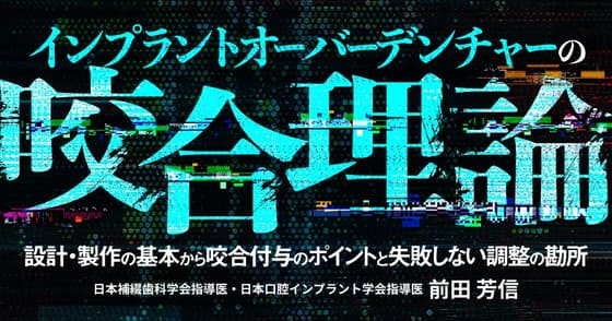 インプラントオーバーデンチャーの咬合理論
