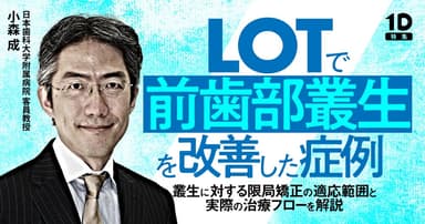LOTで前歯部叢生を改善した症例