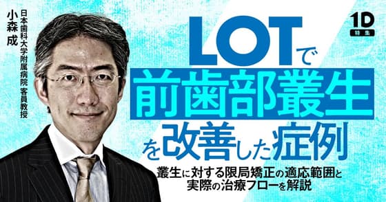LOTで前歯部叢生を改善した症例
