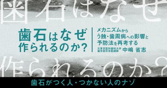 歯石はなぜ、作られるのか？原因や歯石除去術の知見について。